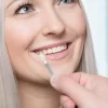 5 Reasons You Should Get Dental Veneers to Restore the Beauty of Your Smile