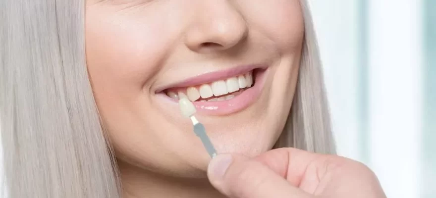 5 Reasons You Should Get Dental Veneers to Restore the Beauty of Your Smile