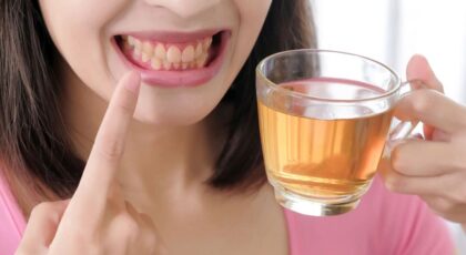 Top 14 Teeth-Staining Foods and Drinks That You Should Be Aware Of
