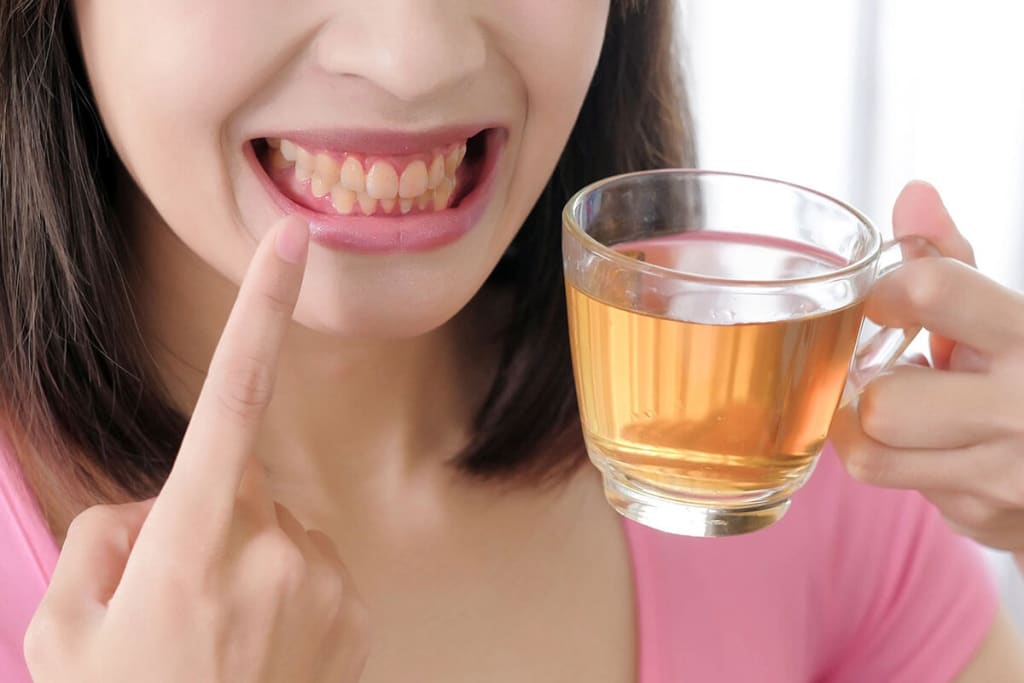 Top 14 Teeth-Staining Foods and Drinks That You Should Be Aware Of