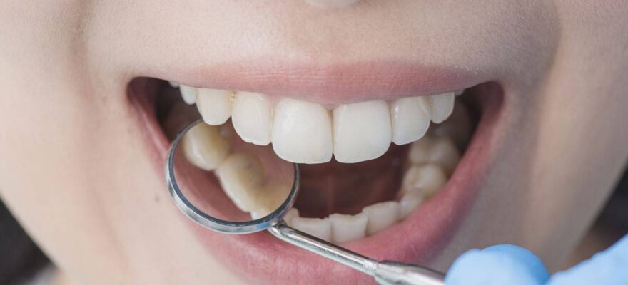 What To Know About Teeth Shifting