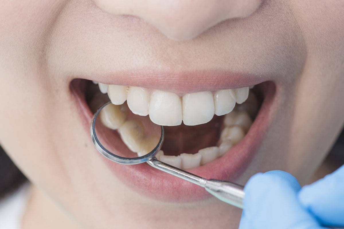 What To Know About Teeth Shifting